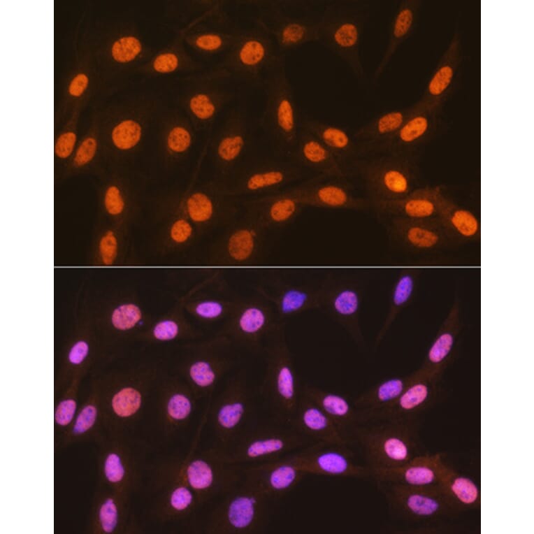 Immunofluorescence - Anti-HP1 alpha Antibody [ARC0244] (A308742) - Antibodies.com