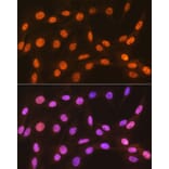 Immunofluorescence - Anti-HP1 alpha Antibody [ARC0244] (A308742) - Antibodies.com