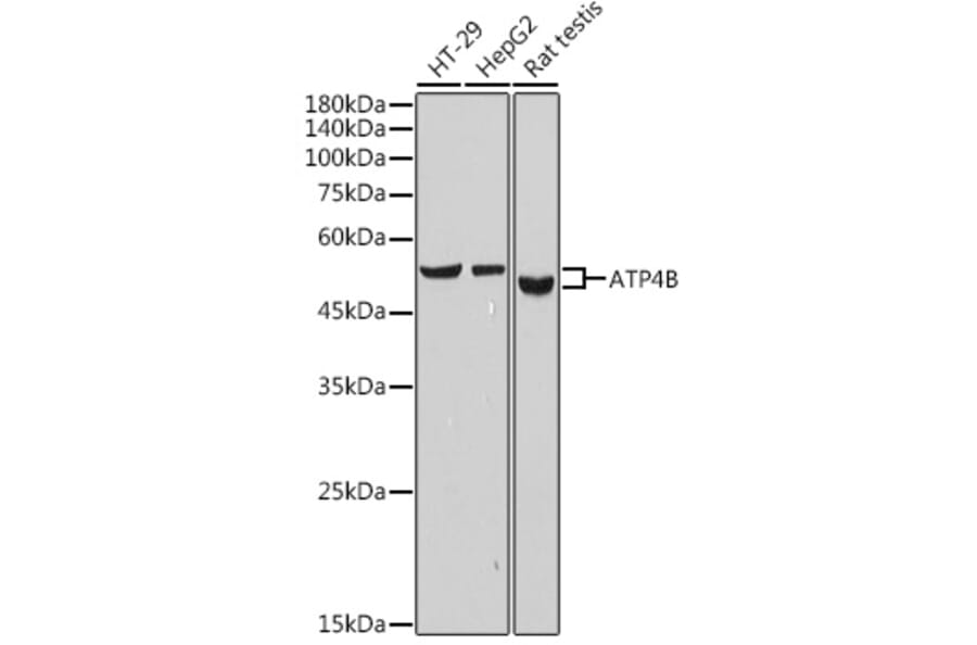 Western Blot - Anti-Hydrogen Potassium ATPase Beta/ATP4B Antibody [ARC2461] (A308743) - Antibodies.com