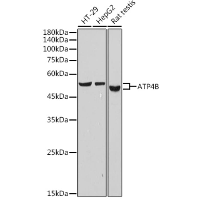 Western Blot - Anti-Hydrogen Potassium ATPase Beta/ATP4B Antibody [ARC2461] (A308743) - Antibodies.com