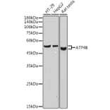 Western Blot - Anti-Hydrogen Potassium ATPase Beta/ATP4B Antibody [ARC2461] (A308743) - Antibodies.com