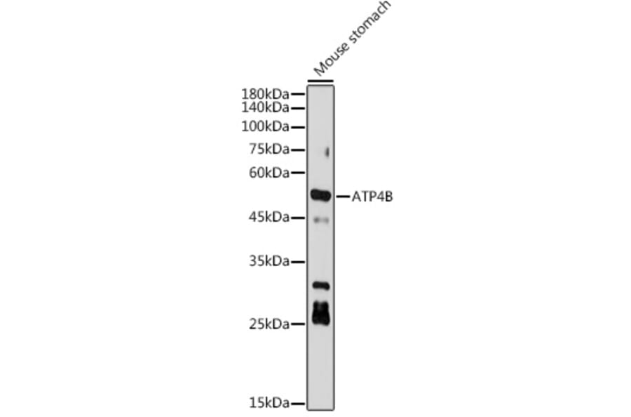 Western Blot - Anti-Hydrogen Potassium ATPase Beta/ATP4B Antibody [ARC2461] (A308743) - Antibodies.com
