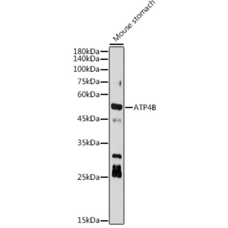 Western Blot - Anti-Hydrogen Potassium ATPase Beta/ATP4B Antibody [ARC2461] (A308743) - Antibodies.com