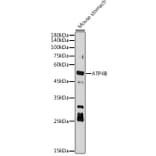 Western Blot - Anti-Hydrogen Potassium ATPase Beta/ATP4B Antibody [ARC2461] (A308743) - Antibodies.com