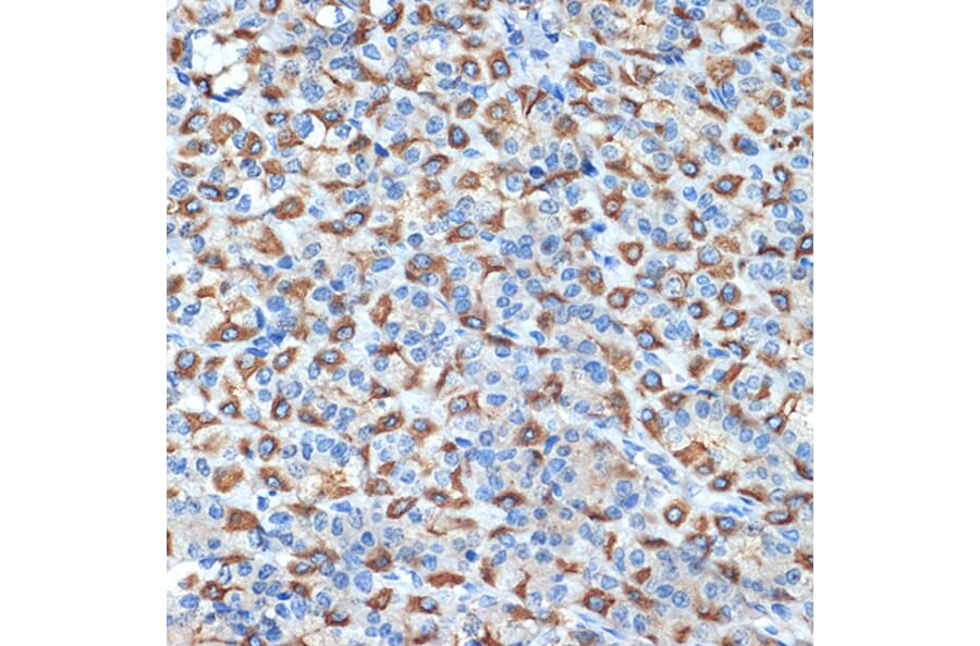 Immunohistochemistry - Anti-Hydrogen Potassium ATPase Beta/ATP4B Antibody [ARC2461] (A308743) - Antibodies.com
