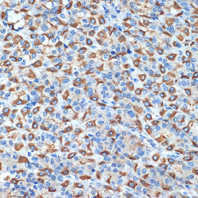 Immunohistochemistry - Anti-Hydrogen Potassium ATPase Beta/ATP4B Antibody [ARC2461] (A308743) - Antibodies.com