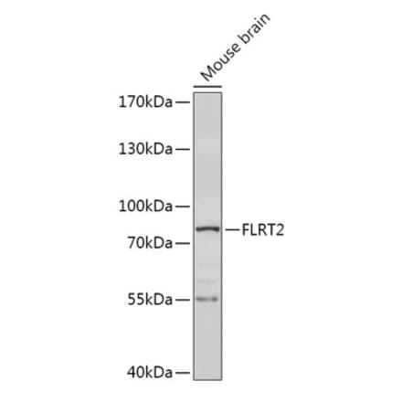 Western Blot - Anti-FLRT2 Antibody (A308744) - Antibodies.com