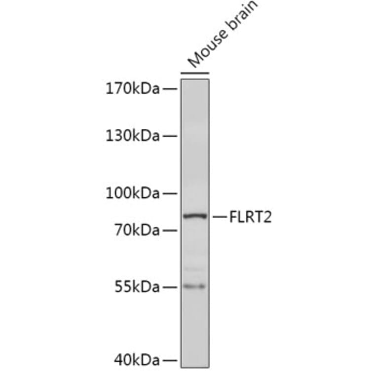 Western Blot - Anti-FLRT2 Antibody (A308744) - Antibodies.com