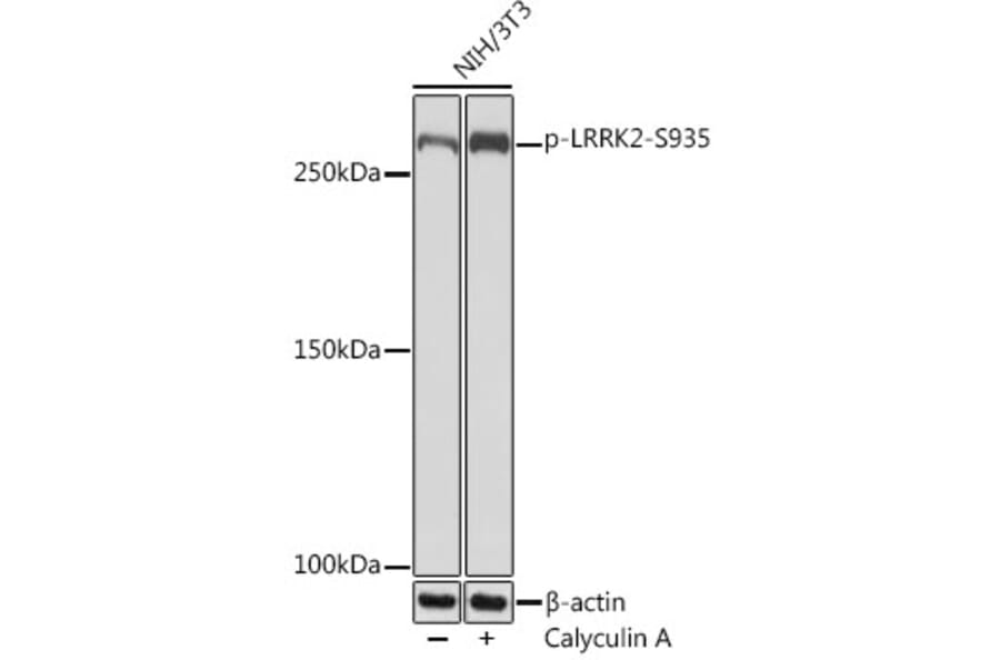 Western Blot - Anti-LRRK2 (phospho Ser935) Antibody [ARC1694] (A308745) - Antibodies.com