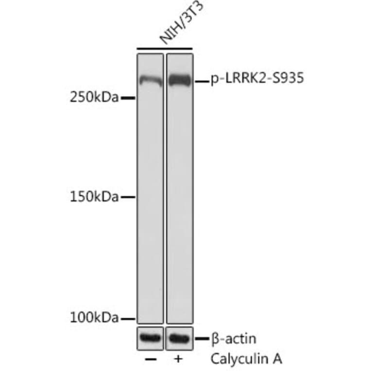 Western Blot - Anti-LRRK2 (phospho Ser935) Antibody [ARC1694] (A308745) - Antibodies.com