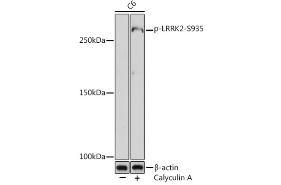 Western Blot - Anti-LRRK2 (phospho Ser935) Antibody [ARC1694] (A308745) - Antibodies.com