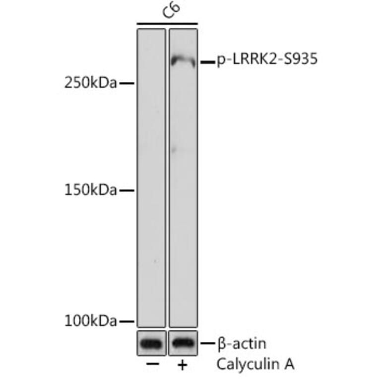 Western Blot - Anti-LRRK2 (phospho Ser935) Antibody [ARC1694] (A308745) - Antibodies.com