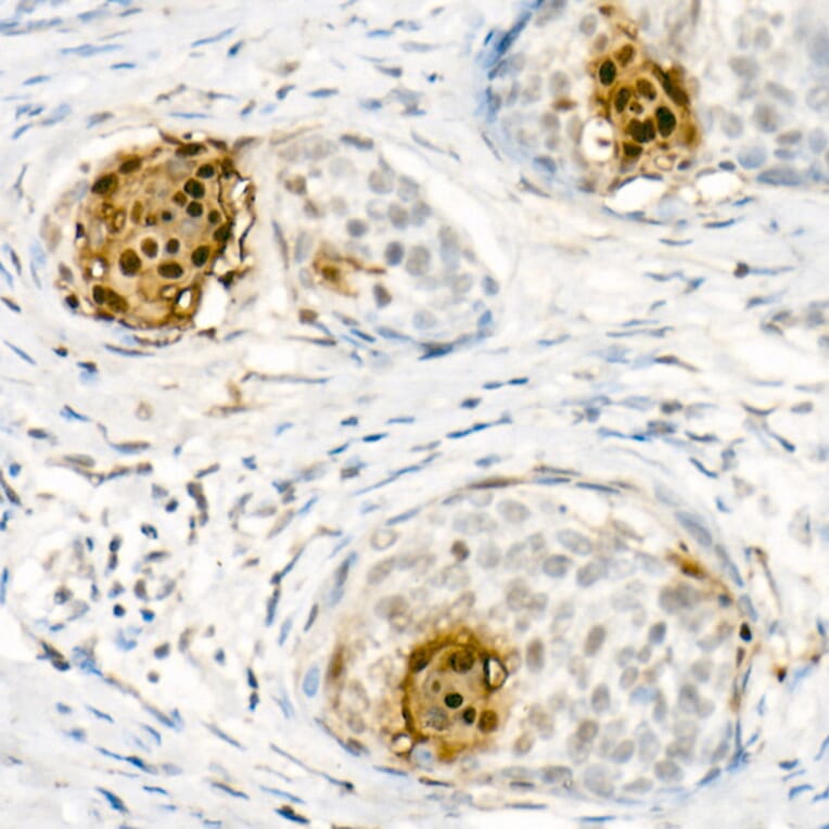 Immunohistochemistry - Anti-Psoriasin Antibody (A308747) - Antibodies.com