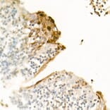 Immunohistochemistry - Anti-Psoriasin Antibody (A308747) - Antibodies.com