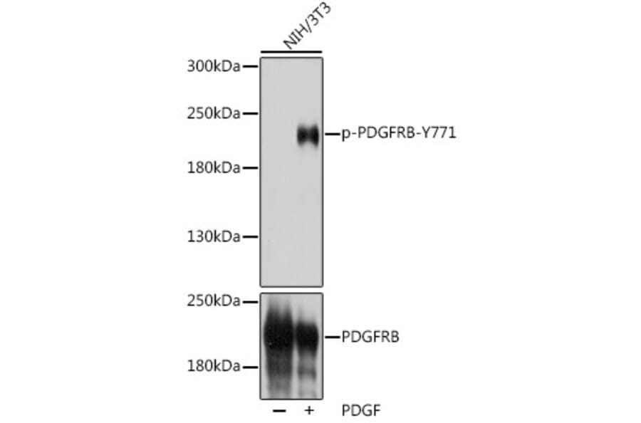 Western Blot - Anti-PDGFR beta (phospho Tyr771) Antibody (A308748) - Antibodies.com