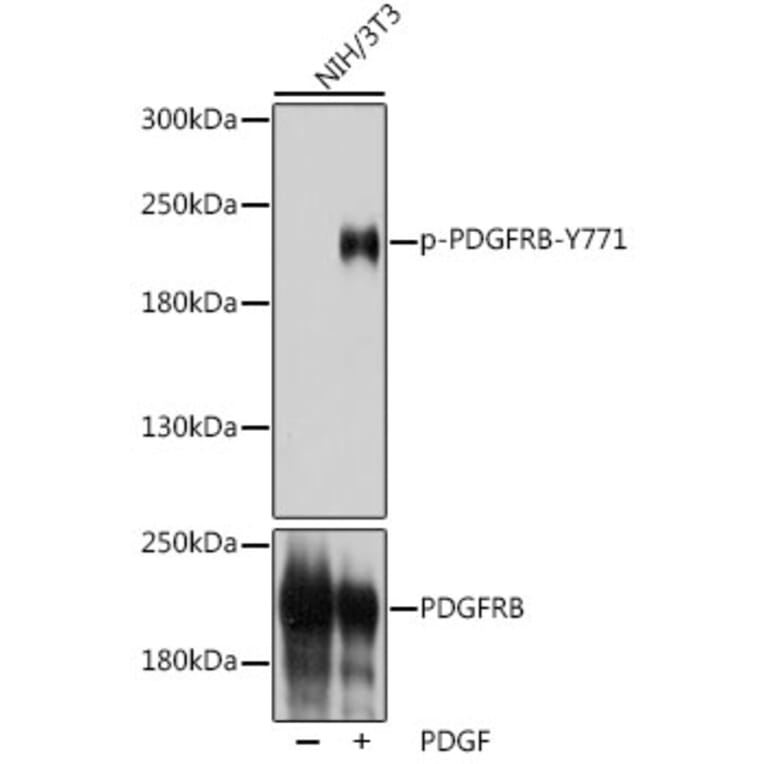 Western Blot - Anti-PDGFR beta (phospho Tyr771) Antibody (A308748) - Antibodies.com
