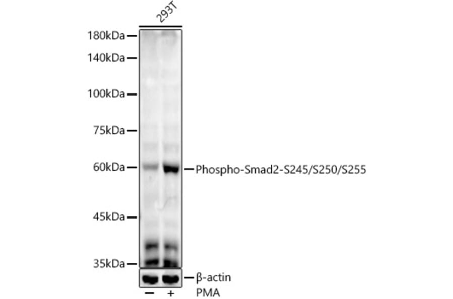 Western Blot - Anti-Smad2 (phospho Ser245 + Ser250 + Ser255) Antibody [ARC53851] (A308749) - Antibodies.com