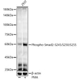 Western Blot - Anti-Smad2 (phospho Ser245 + Ser250 + Ser255) Antibody [ARC53851] (A308749) - Antibodies.com