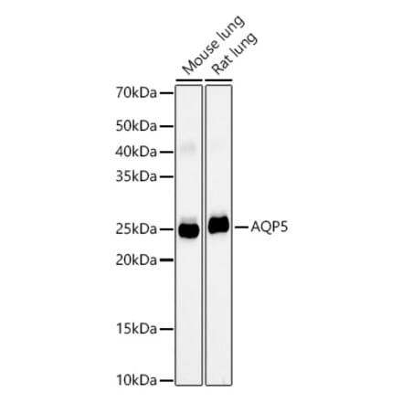 Western Blot - Anti-Aquaporin 5 Antibody [ARC59536] (A308750) - Antibodies.com