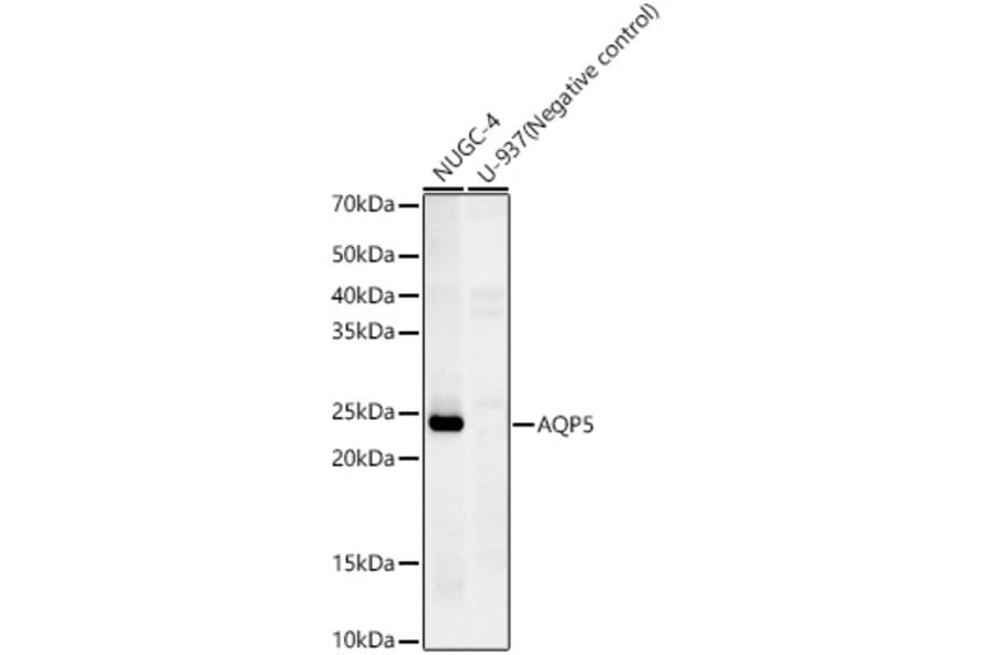 Western Blot - Anti-Aquaporin 5 Antibody [ARC59536] (A308750) - Antibodies.com