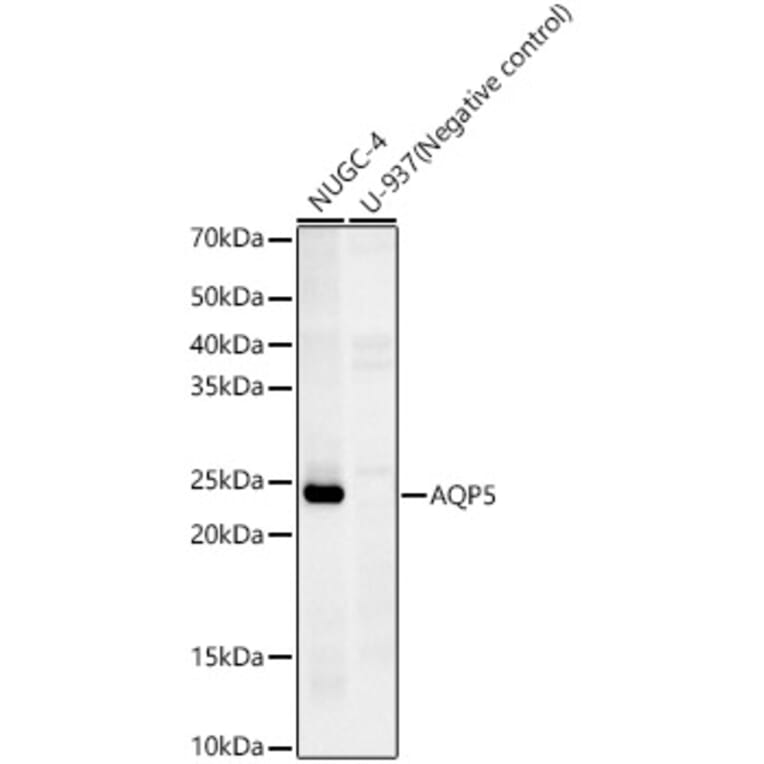 Western Blot - Anti-Aquaporin 5 Antibody [ARC59536] (A308750) - Antibodies.com