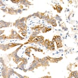 Immunohistochemistry - Anti-Aquaporin 5 Antibody [ARC59536] (A308750) - Antibodies.com