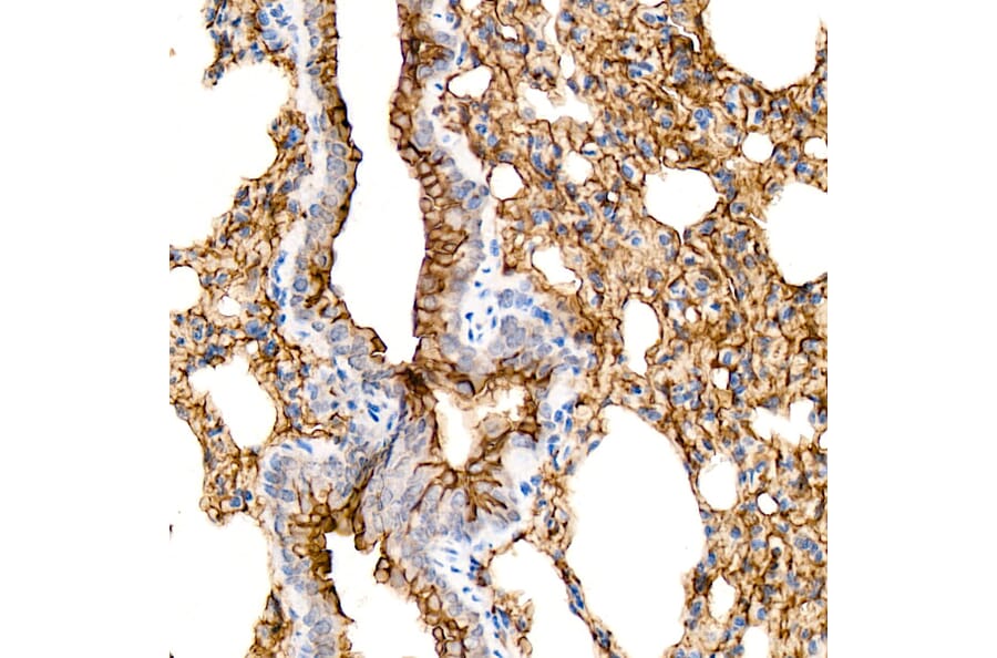 Immunohistochemistry - Anti-Aquaporin 5 Antibody [ARC59536] (A308750) - Antibodies.com