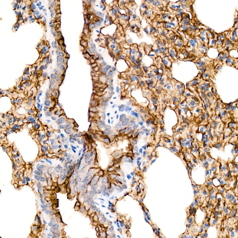 Immunohistochemistry - Anti-Aquaporin 5 Antibody [ARC59536] (A308750) - Antibodies.com