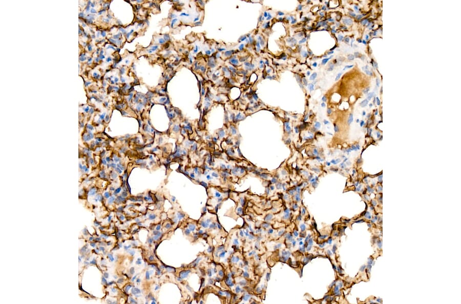 Immunohistochemistry - Anti-Aquaporin 5 Antibody [ARC59536] (A308750) - Antibodies.com