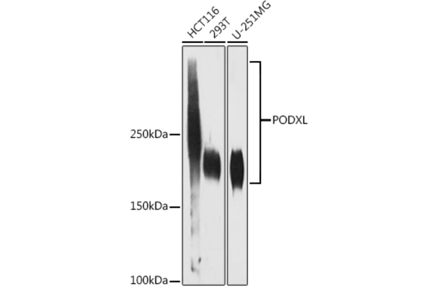 Western Blot - Anti-PODXL Antibody [ARC1031] (A308751) - Antibodies.com