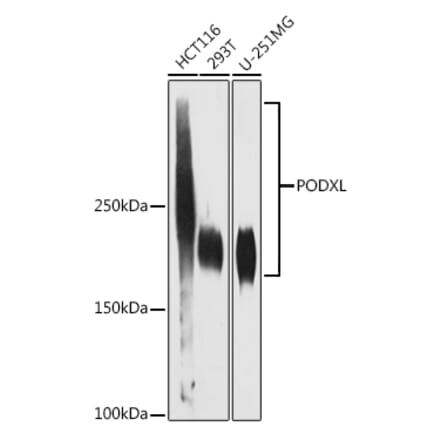 Western Blot - Anti-PODXL Antibody [ARC1031] (A308751) - Antibodies.com