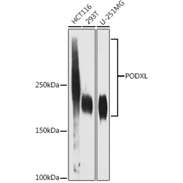 Western Blot - Anti-PODXL Antibody [ARC1031] (A308751) - Antibodies.com
