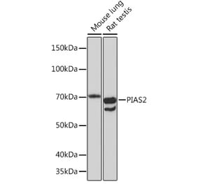 Western Blot - Anti-PIAS2 Antibody [ARC1256] (A308752) - Antibodies.com