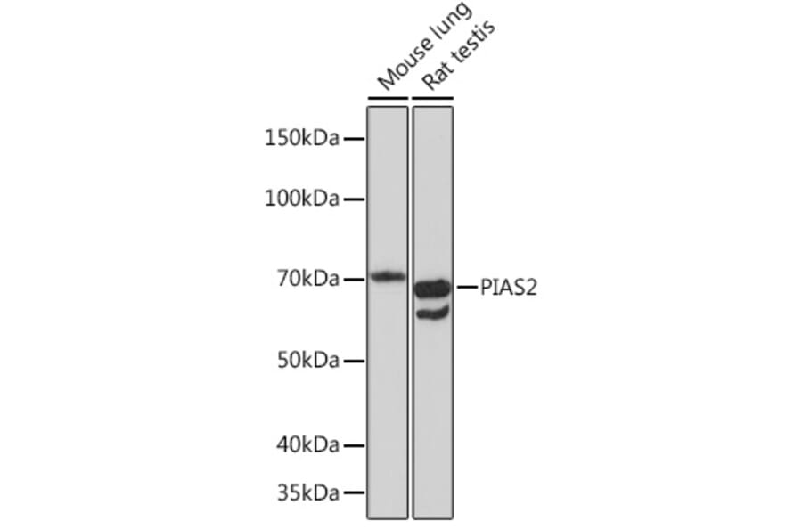 Western Blot - Anti-PIAS2 Antibody [ARC1256] (A308752) - Antibodies.com