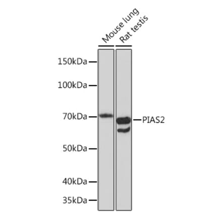 Western Blot - Anti-PIAS2 Antibody [ARC1256] (A308752) - Antibodies.com