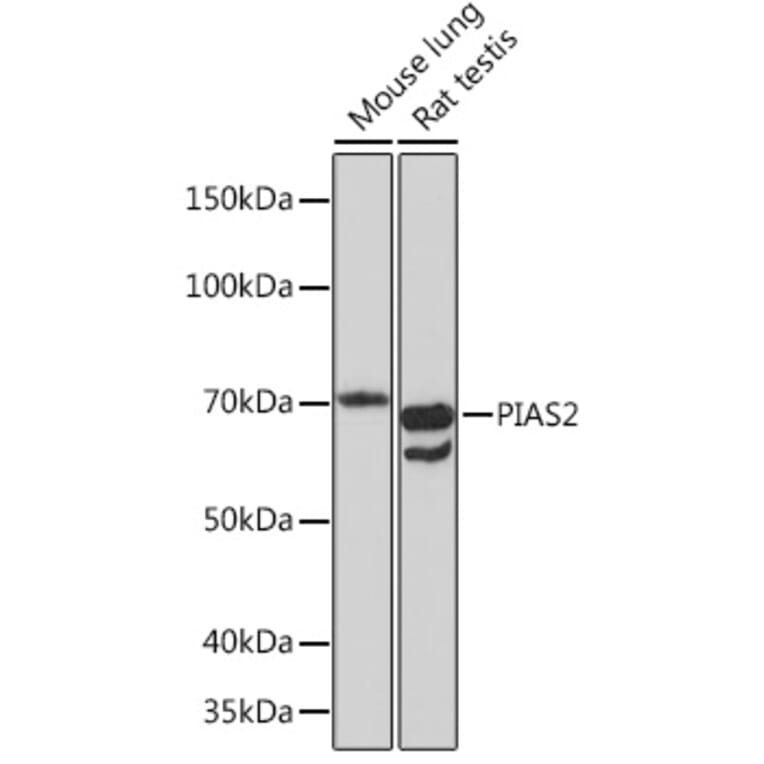 Western Blot - Anti-PIAS2 Antibody [ARC1256] (A308752) - Antibodies.com