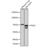 Western Blot - Anti-PIAS2 Antibody [ARC1256] (A308752) - Antibodies.com