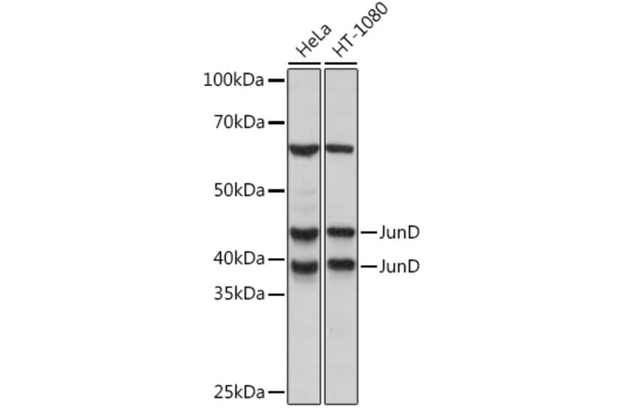 Western Blot - Anti-JunD Antibody [ARC1408] (A308753) - Antibodies.com