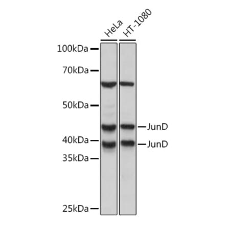 Western Blot - Anti-JunD Antibody [ARC1408] (A308753) - Antibodies.com
