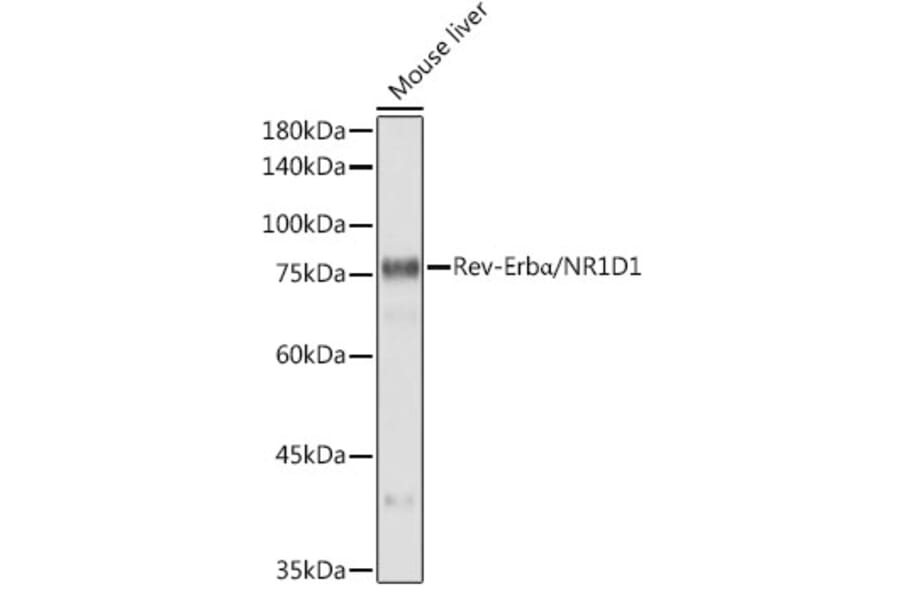Western Blot - Anti-NR1D1 Antibody [ARC50483] (A308754) - Antibodies.com