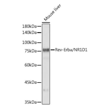 Western Blot - Anti-NR1D1 Antibody [ARC50483] (A308754) - Antibodies.com