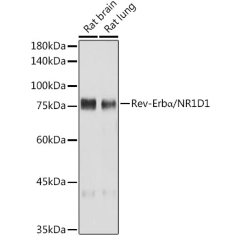 Western Blot - Anti-NR1D1 Antibody [ARC50483] (A308754) - Antibodies.com