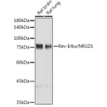 Western Blot - Anti-NR1D1 Antibody [ARC50483] (A308754) - Antibodies.com