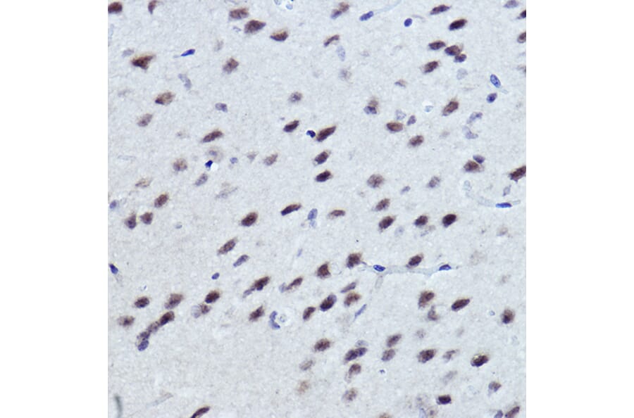 Immunohistochemistry - Anti-NR1D1 Antibody (A308755) - Antibodies.com
