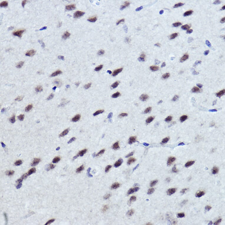 Immunohistochemistry - Anti-NR1D1 Antibody (A308755) - Antibodies.com