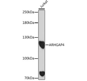 Western Blot - Anti-ARHGAP4 Antibody (A308756) - Antibodies.com