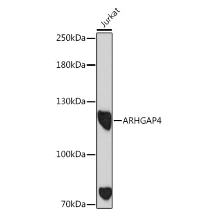 Western Blot - Anti-ARHGAP4 Antibody (A308756) - Antibodies.com