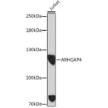 Western Blot - Anti-ARHGAP4 Antibody (A308756) - Antibodies.com