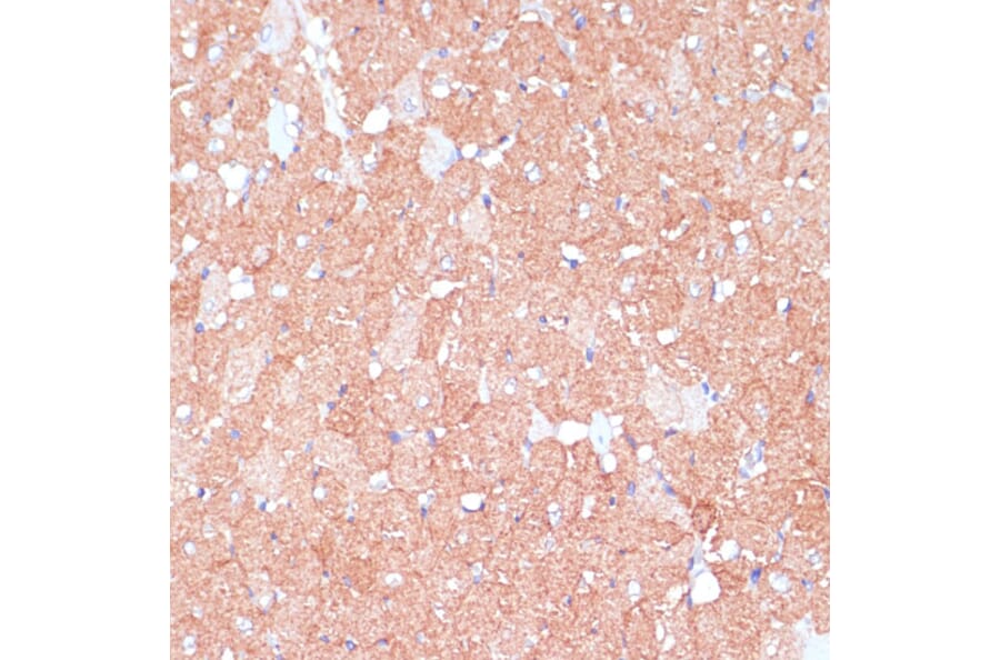Immunohistochemistry - Anti-ARHGAP4 Antibody (A308756) - Antibodies.com