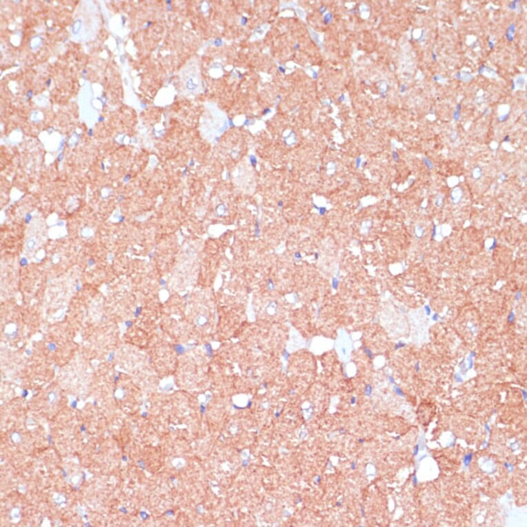 Immunohistochemistry - Anti-ARHGAP4 Antibody (A308756) - Antibodies.com